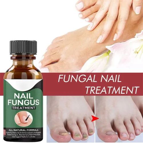 Nail Fungus Treatment Serum | Fast Nail Repair Essence Gel for Healthy & Strong Nails