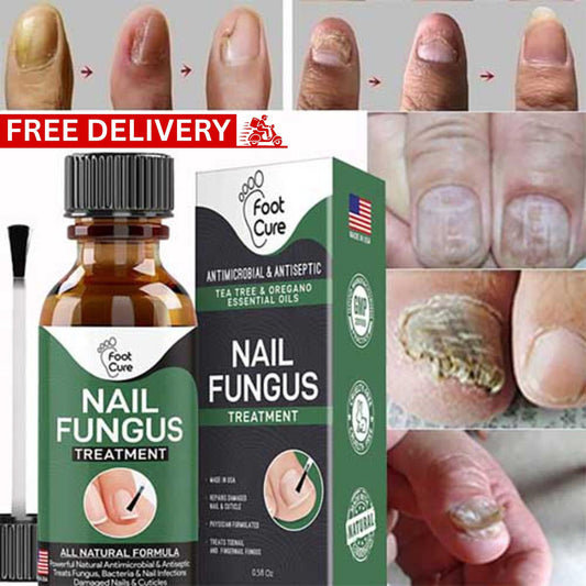 Nail Fungus Treatment Serum | Fast Nail Repair Essence Gel for Healthy & Strong Nails
